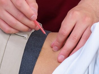 てて整骨院 針ヶ谷店/施術の様子