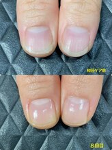 クーラ アンド ベリッシモ(Cura&Bellissimo)/