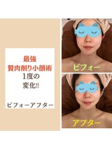 ドクターマジックタッチ(Dr.MAGIC TOUCH)/【劇的小顔術】ビフォーアフター