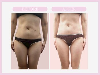 スリムライン 弘前店(The Slim Line)/before→after