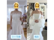 トータルボディケア サニー(TOTAL BODY CARE)/ブライダルエステbefore after