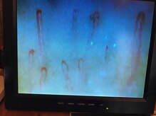 セル(CELL)/あなたの肌トラブルの原因は？