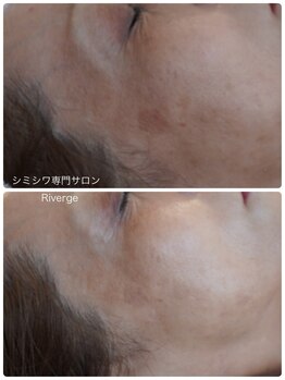 リバージュ(Riverge)/