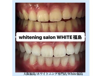 ホワイトニングサロン ホワイト(WHITE)/セルフホワイトニング/大阪/福島