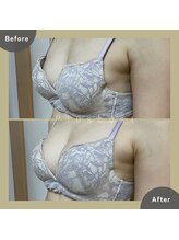 プラス バスト(+Plusバスト)/お客様BeforeAfterお写真