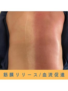 いつつのき/スライドカッピング