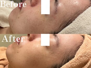 カレンジェビューティー(CarengeBeauty)/プラチナクレイピール