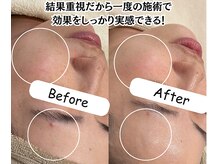 ケア ラウンジ ザ ファースト(THE F1RST)の雰囲気（当店の肌質改善は結果を重視＊それぞれの肌状況に合った施術に＊）
