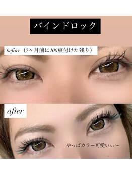 シュピネ(Choupinet)/◯バインドロック×カラー◯