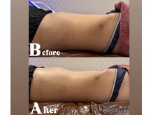 シャルム(CHARME)の雰囲気(インディバ最新EDNAPLUS導入店【術前/術後/拘縮ケアも得意】)