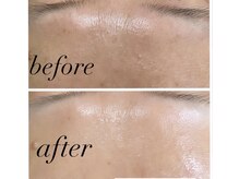 マハ(maha)/高濃度炭酸パック