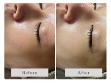 ルリアン(Lurian)/たった1回60分で！before→after