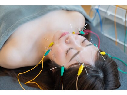 あかり鍼灸接骨院の写真