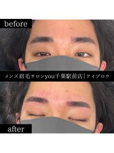 ユー 千葉駅前店(you)/ビフォ－アフター写真