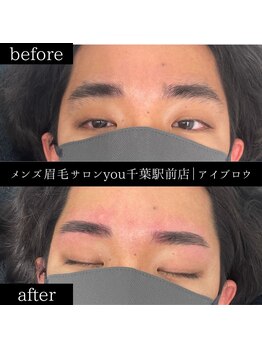 ユー 千葉駅前店(you)/ビフォ－アフター写真