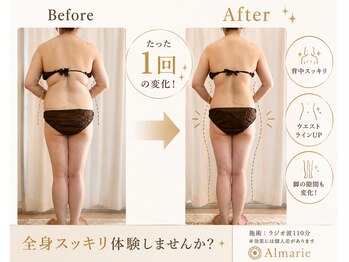 アロマリエ(al malie)の写真/何をしても痩せなかった方へ◆ラジオ波専門サロンの結果重視ダイエット