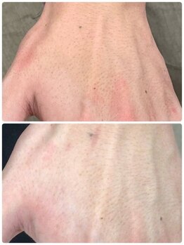 カシワビューティーココ(kashiwa beauty coco)/美肌脱毛