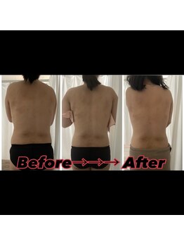 メリンダ(Merinda)/