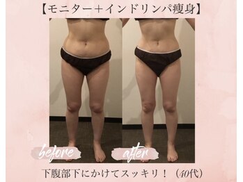 オキシー グレイス 小倉店(OXY Grace)/40代お客様ビフォーアフター