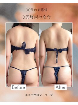 リープ(lieb)/お客様before→after