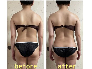 ラレコルト/ビフォーアフター