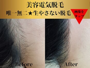 ベルアンドヘルス 千葉(BELL&HEALTH)/美容電気脱毛★デザインもお任せ