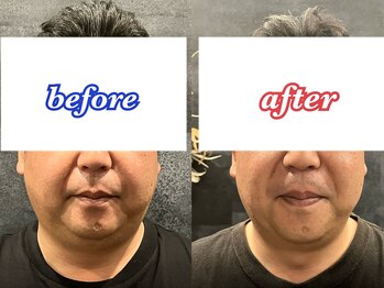 アモーラ(Amora)/脂肪撃退レモンボトル