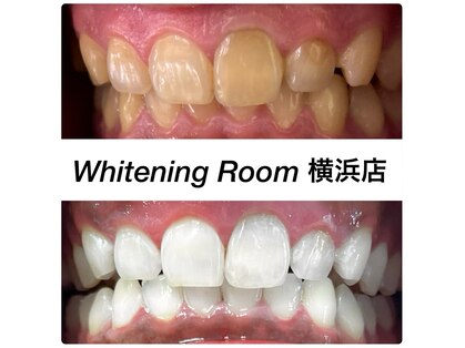ホワイトニングルーム 横浜店(Whitening Room)の写真