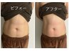 韓国レモンボトル4ccキャビ×ラジオ波【全身脂肪燃焼90分】25000円→7770円