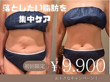 ビーグレイス(Vigrace)