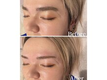 アカヌケ(AKANUKE)/メンズ美眉WAX脱毛