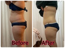 メリンダ(Merinda)/