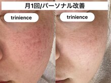トリニエンス 南流山店/30代/パーソナル改善