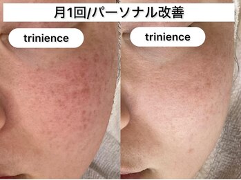 トリニエンス 南流山店/30代/パーソナル改善