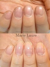 マリーロール 梅田店(Marie Laure)/深爪矯正/自爪育成/自爪風