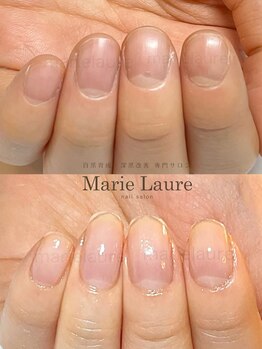マリーロール 梅田店(Marie Laure)/深爪矯正/自爪育成/自爪風