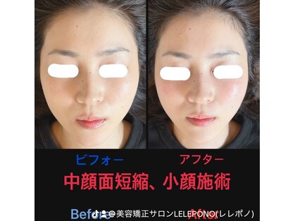 美容矯正サロン レレポノ(LELEPONO)の写真