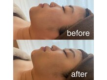 プール エドボリ(POOL EDOBORI)/小顔コルギで横顔美人に♪