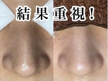 アンドピエル(AndPiel)の雰囲気（結果重視のサロンケア！後悔させません。）