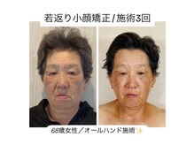真美(Sinbi)の雰囲気（年齢より上に見られてましたが、今ではマスクが外せるように♪）