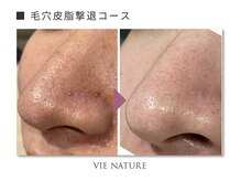 ヴィナチュール(vie nature)/ ■毛穴ケア