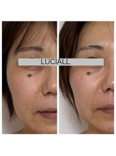 ルシアル(LUCIALL)/