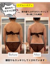 アイシー(I Sea)/バザルトボディ＋ヘッド