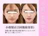 【速攻小顔×上半身矯正】筋膜×猫背矯正×リンパ×鼻矯正６０分