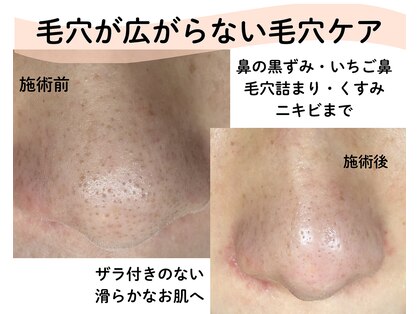 リアン(LIAN)の写真