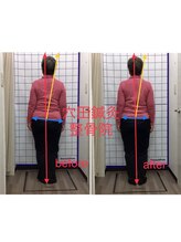 穴田鍼灸整骨院/整体・骨盤・ねこぜ・まき肩矯正