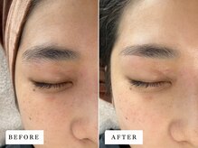 ビビ(BiBi)/余分な箇所を丁寧に抜きます