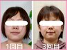★小顔矯正【左右差,歪み,むくみハリ,小顔】初回体験（残5名）