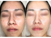 ウォナ(WONA)/【お客様症例】