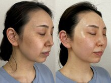 モモラ(Spa MoMora)の雰囲気（【本当に変わりたい方限定！】短期集中ケアで効果を実感♪）